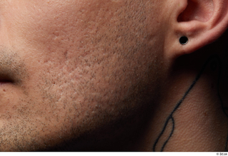 HD Face Skin Shawn Jacobs cheek chin ear face skin…